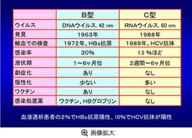 ウイルス性肝炎の比較